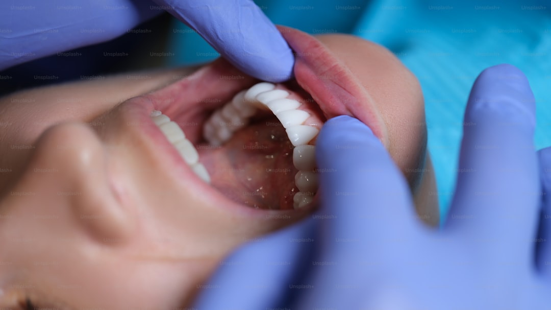 Cosmetic dentistry 3.jpg at Pure Smiles Fulham