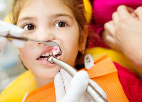 The Pure Smiles Promise: Why Our Fulham Dental Practice Is Different