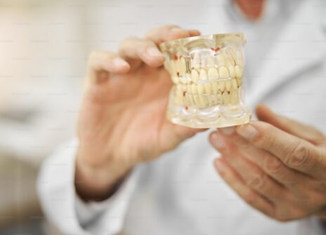 How Pure Smiles Ensures Your Dental Restorations Are in the Best Hands