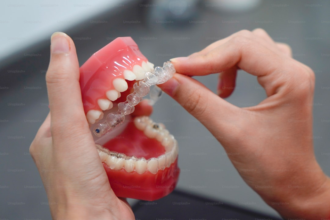 Invisalign 1.jpg at Pure Smiles Fulham