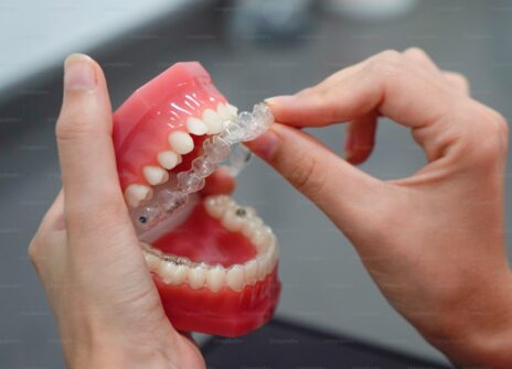 Invisalign vs Traditional Braces: Which Is Right for You?