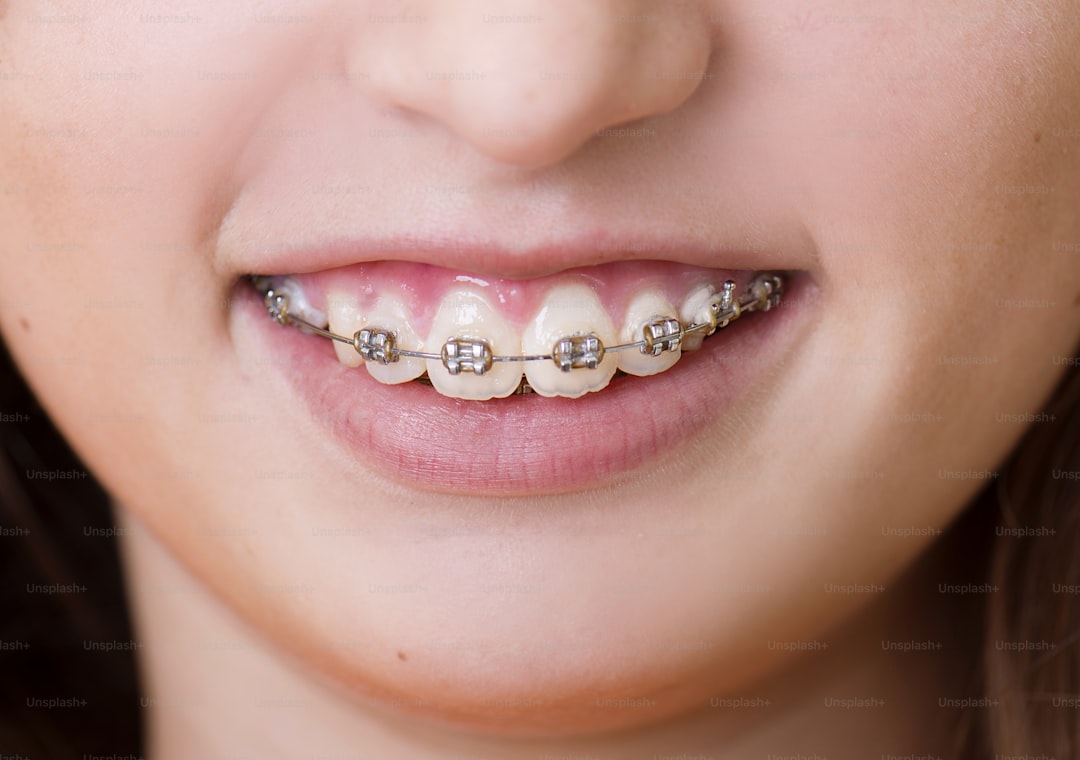Orthodontics 1.jpg at Pure Smiles Fulham
