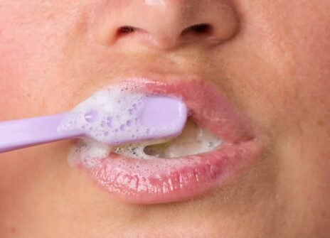 How Often Should You Go to the Dentist? A Complete Guide