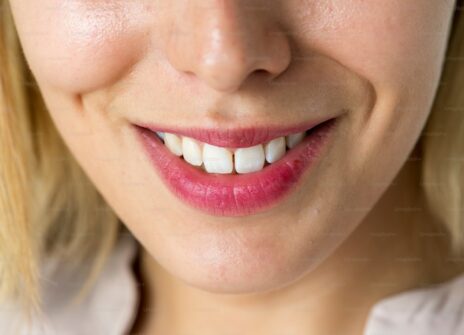 Cosmetic Dental Treatments That Boost Confidence: What Pure Smiles Fulham Offers