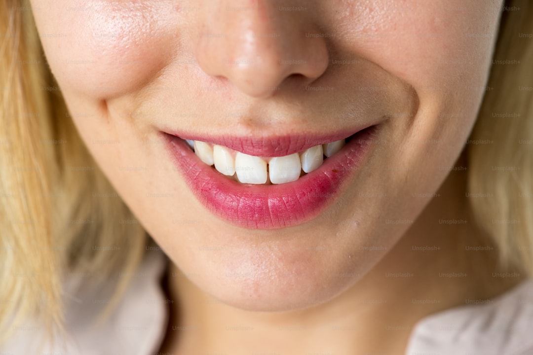 Teeth whitening 1.jpg at Pure Smiles Fulham
